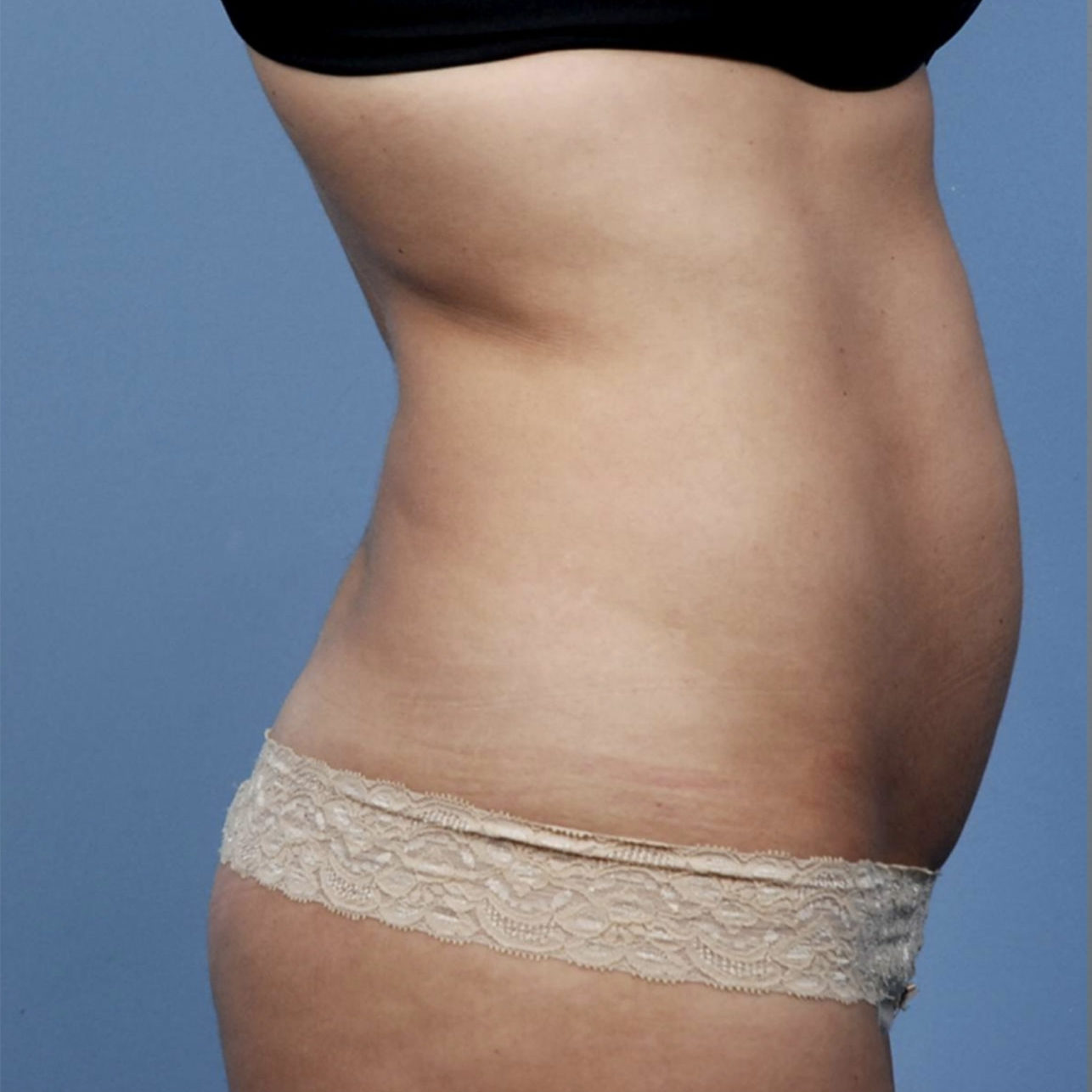 SM_BODYFX_2b_RS_40to45W