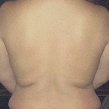 back-after