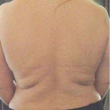 back-before