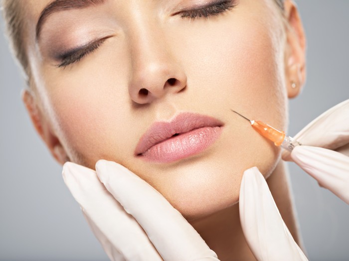 Cheek-Filler-Northglenn-CO