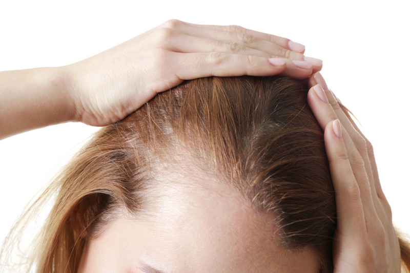 Hair-Transplant-Denver-CO