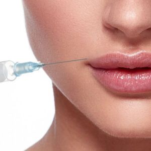 JUVEDERM®