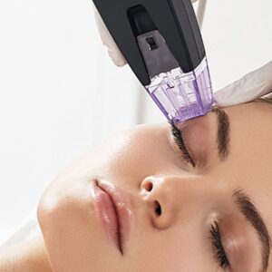Flawless Face Morpheus8 Skin Resurfacing
