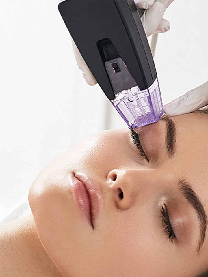 Lafayette Cheek Filler